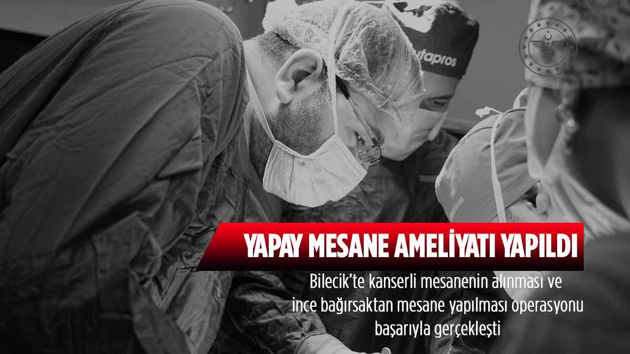 Bilecik’te İlk Kez Yapay Mesane Ameliyatı Yapıldı